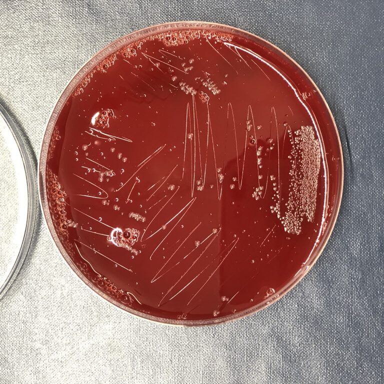 Mengdi paints Fusobacterium nucleatum onto sheep blood agar one red and one white petri dish